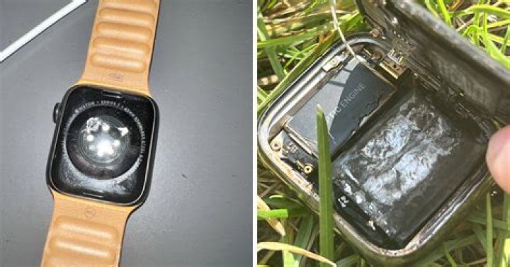 
Apple Watch battery heated up and exploded, claims use 