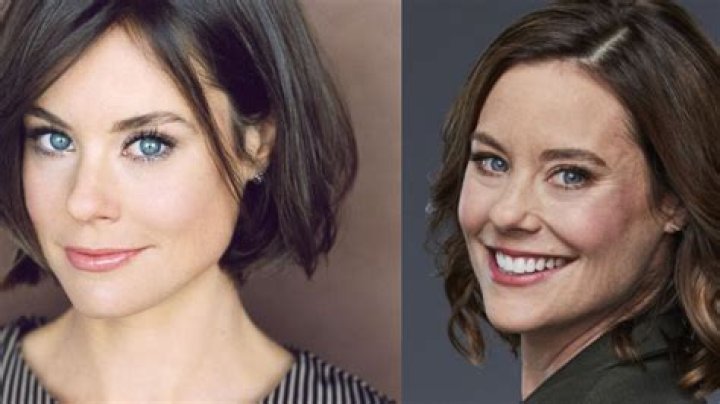 Ashley Williams Plastic Surgery- Before & After Pictures