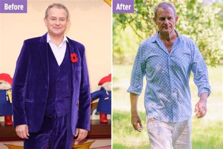 Did Hugh Bonneville Lose So Much Weight? Transformation Photos And Health Update