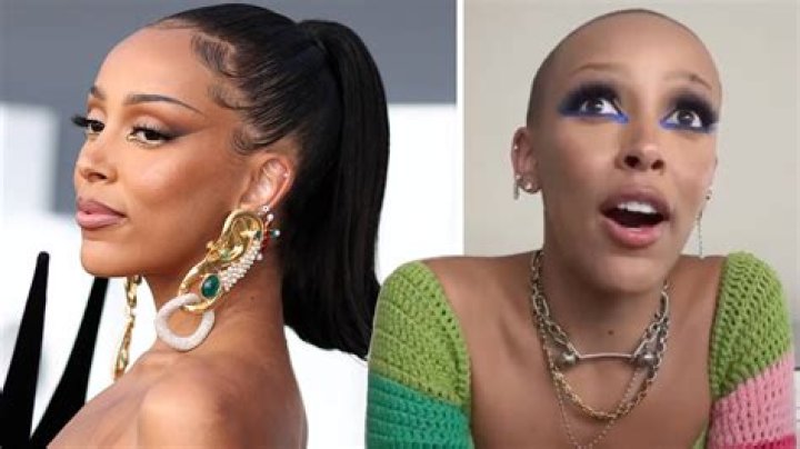 
Doja Cat Addresses Concerns After Shaving Her Head 