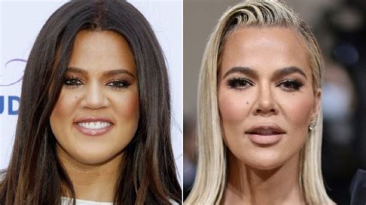 
Khloe Kardashian Before And After Her Brazilian Lift; Is It Real? 