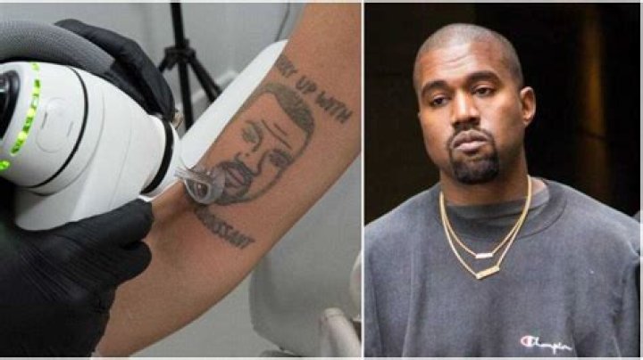 
London-Based Tattoo Studio Is Offering to Remove Kanye West Tattoos for Free 