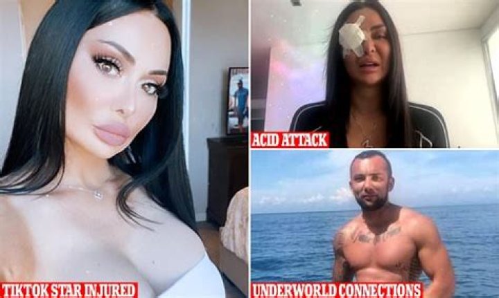 
Steven Elmir Was Married To Wife Alia Elhassan, Jenny Elhassan’s Acid Attack Takes A Turn As Her Relationship To The Underworld Is Revealed 