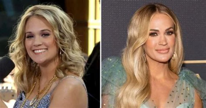 What Happened To Carrie Underwoods Lips? Who Is Carrie Underwood?