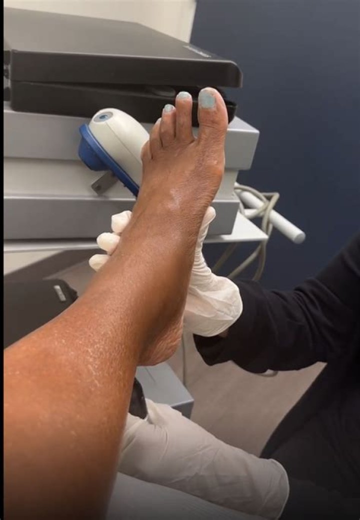 What Happened To Gayle King’s Foot? Ankle And Feet Surgery And Injury Update