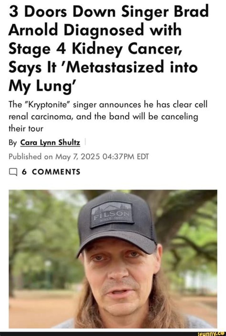 
What Happened To Peter Frampton? Singer Diagnosed With IBM Unable To Perform For Long 