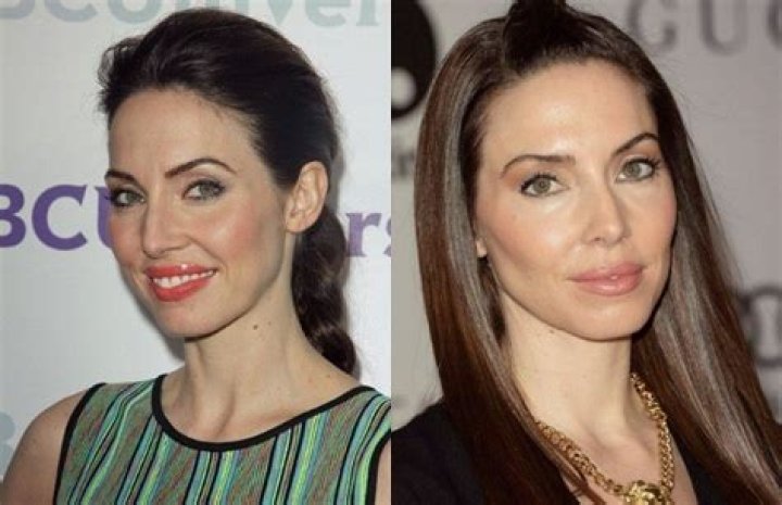 Whitney Cummings Plastic Surgery: Everything You Should Know