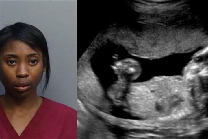 
Who is Natalia Harrell? Pregnant Florida woman argues to be freed as fetus is innocent 