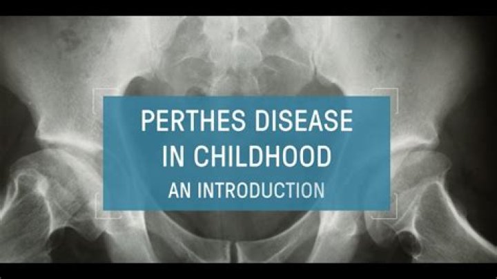 
Who is Volker Perthes? 